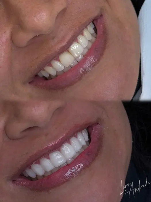 Resultado antes e depois 3