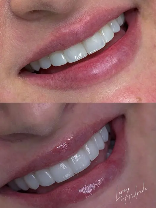 Resultado antes e depois 9